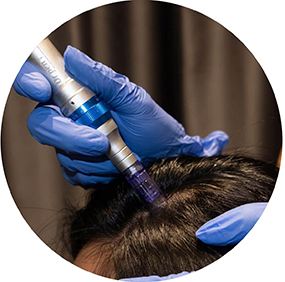 dermapen microneedling