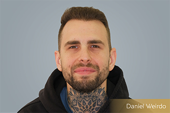 daniel weirdo hajbeültetés eredmény