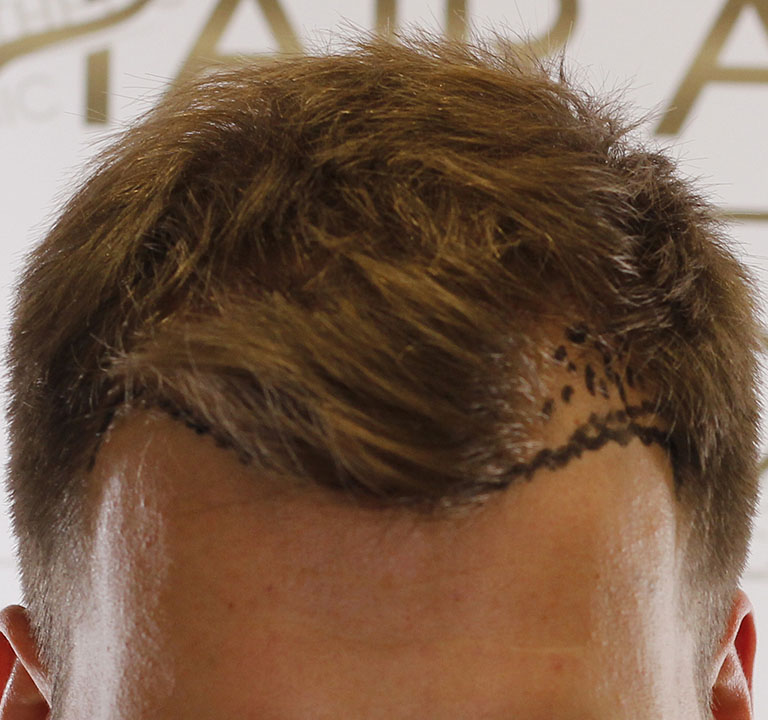 A hajvonalak zónái