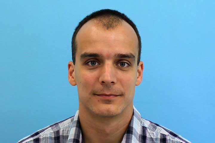 Harsányi Gergely hajbeültetése
