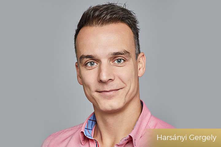 Harsányi Gergely hajbeültetése